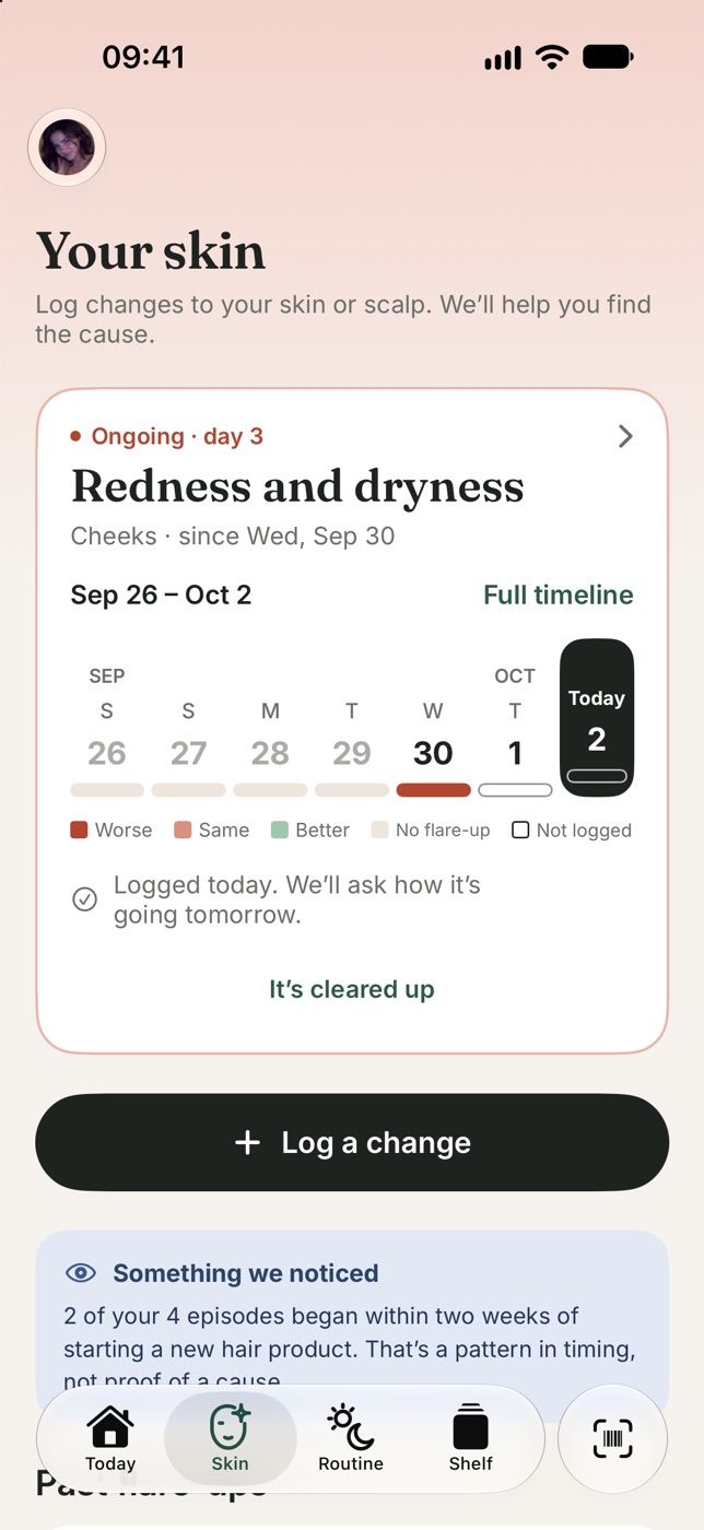 Petal's Skin tab: an ongoing flare-up, redness and dryness on the cheeks, day 3, with the week day by day, a Today check-in of Better, Same or Worse, and Log a change.